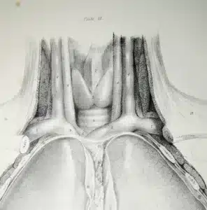 Cricothyroidotomy Training - Anatomy Sketch of the Neck